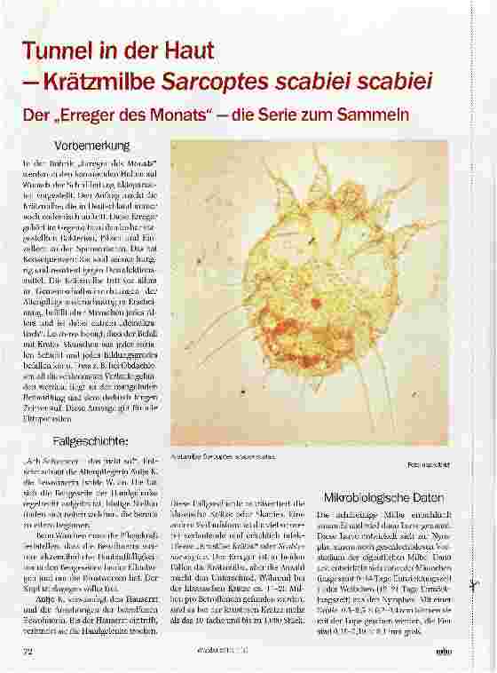 Vorschauseite 1: Tunnel in der Haut - Krätzmilbe Sarcoptes scabiei scabiei