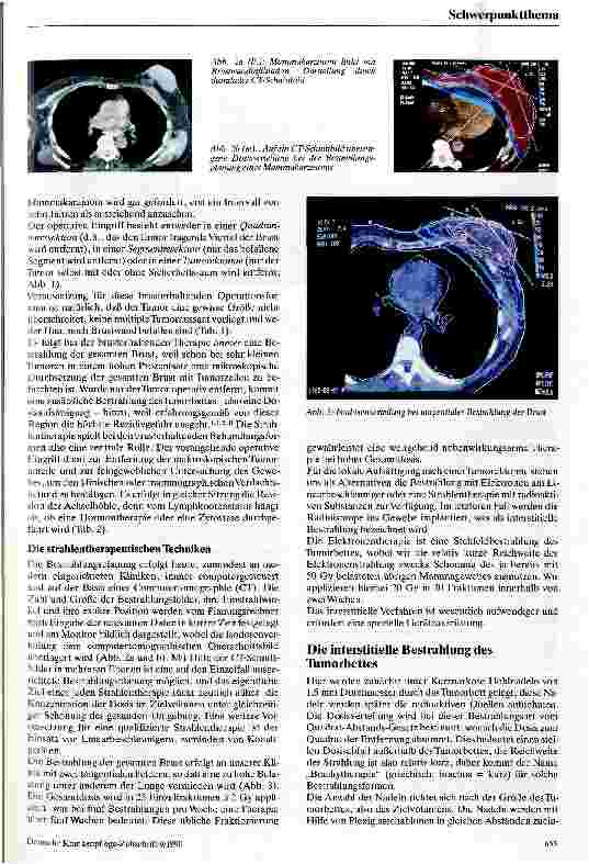 Vorschauseite 3: Die interstitielle Strahlentherapie bei der Behandlung des Mammakarzinoms