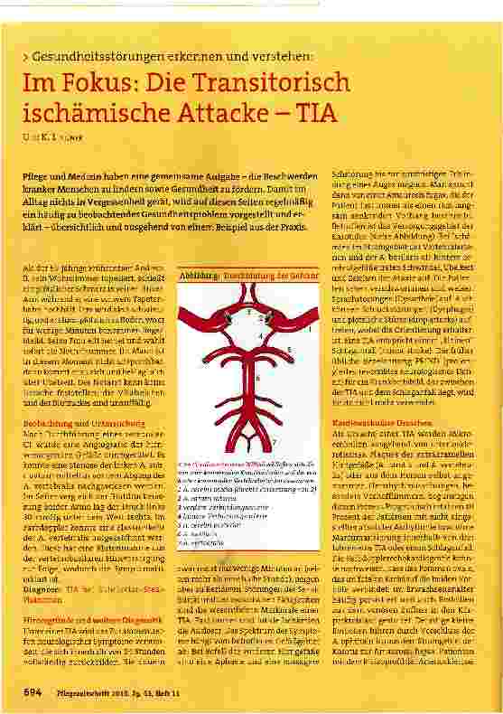 Vorschauseite 1: Im Fokus: Die Transitorisch ischämische Attacke - TIA