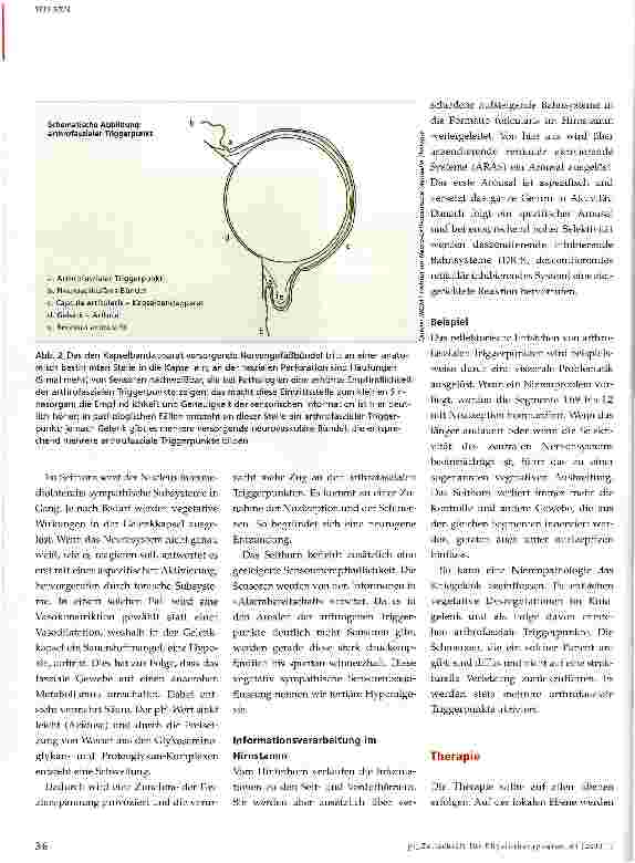 Vorschauseite 3: Arthrofasziale Triggerpunkte