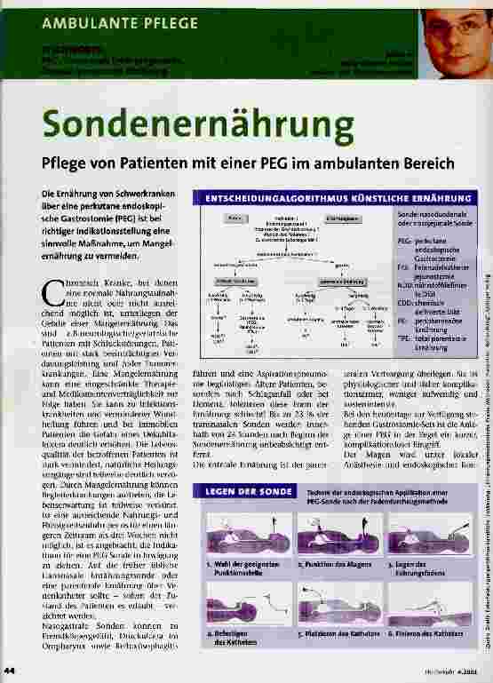 Vorschauseite 1: Sondenernährung Pflege von Patienten mit einer PEG im ambulanten Bereich