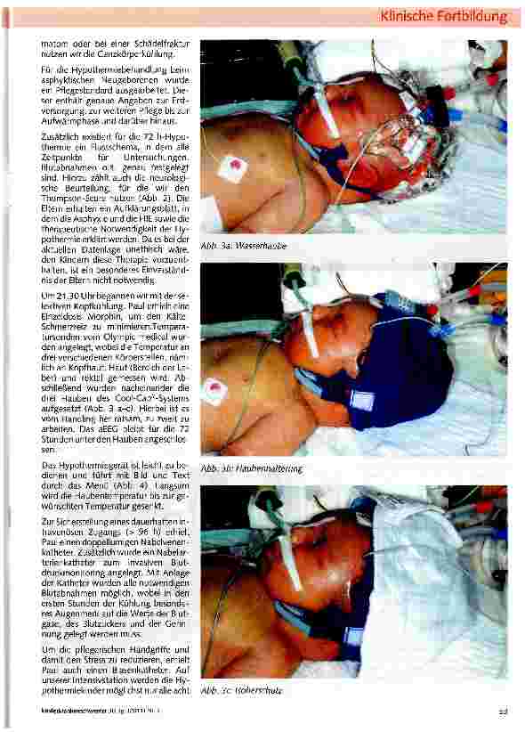 Vorschauseite 3: Die Hypothermiebehandlung beim asphyktischen Neugeborenen