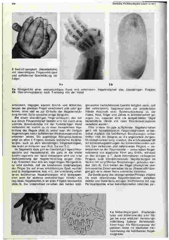 Vorschauseite 2: Entwicklungsstörungen der Fingerund Zehennägel