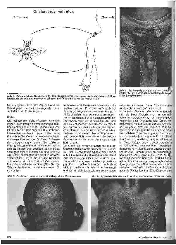 Vorschauseite 3: Wurminfektionen - Filaiasis