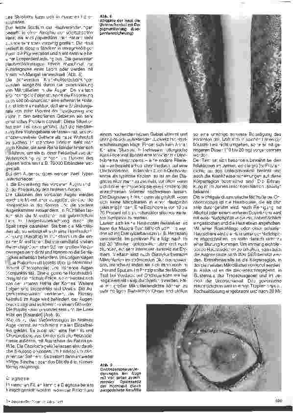 Vorschauseite 4: Wurminfektionen - Filaiasis