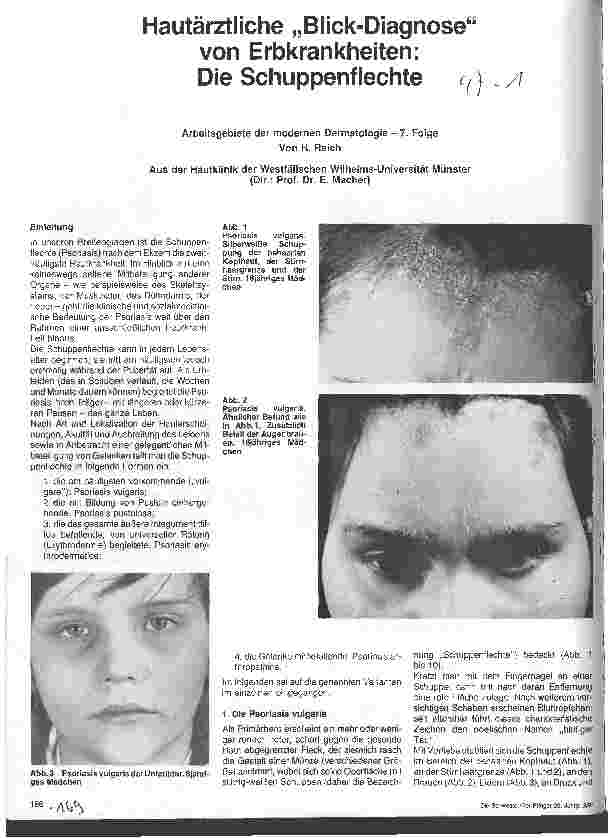 Vorschauseite 1: Hautärztliche Blick-Diagnose von Krankheiten: Die Schuppenflechte