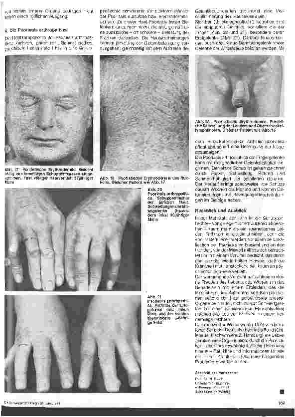 Vorschauseite 4: Hautärztliche Blick-Diagnose von Krankheiten: Die Schuppenflechte