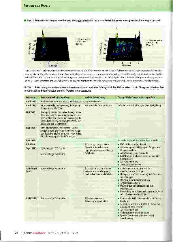 Vorschauseite 3: Wiedergewinnung der Kommunikation bei einem Locked-in-Syndrom
