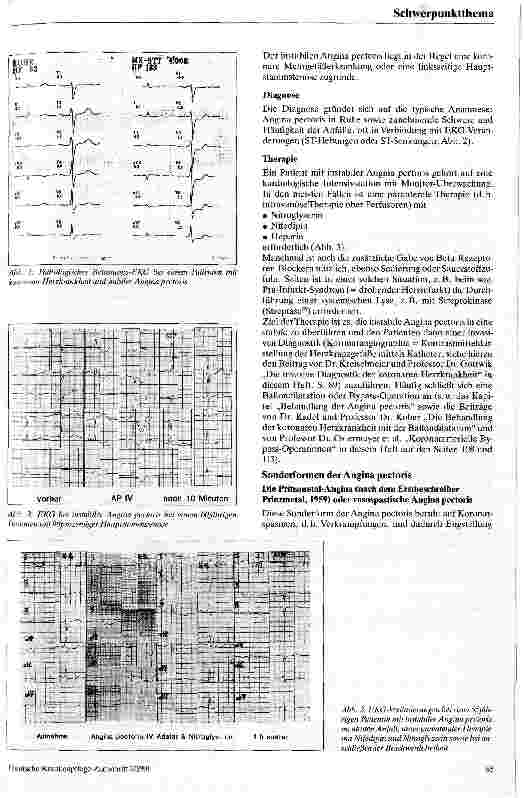 Vorschauseite 2: Angina pectoris - Vorstufe zum Herzinfarkt