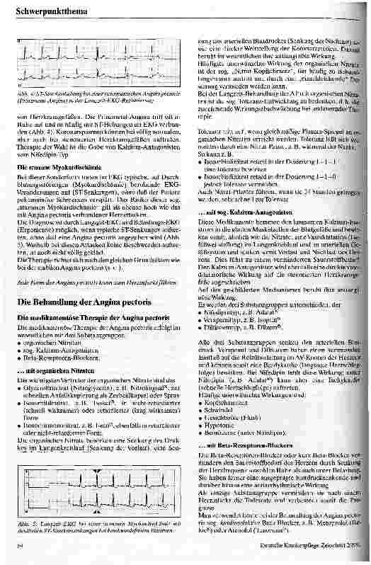 Vorschauseite 3: Angina pectoris - Vorstufe zum Herzinfarkt