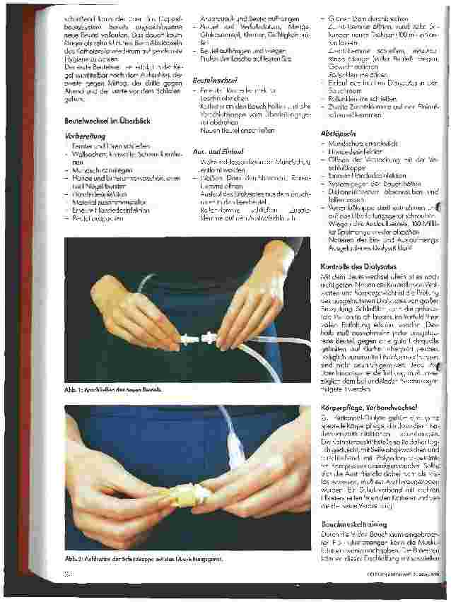 Vorschauseite 2: Die Ambulante Peritoneal-Dialyse 2. Teil