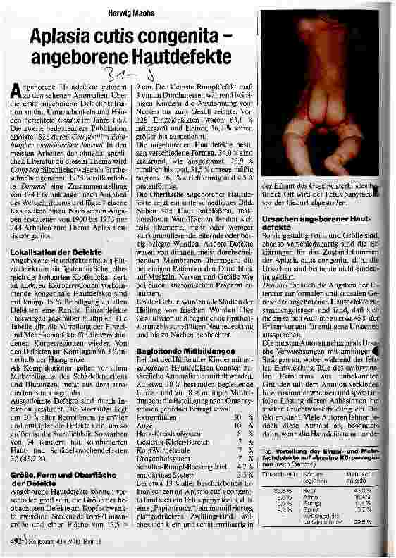 Vorschauseite 1: Aplasia cutis congenita - angeborene Hautdefekte