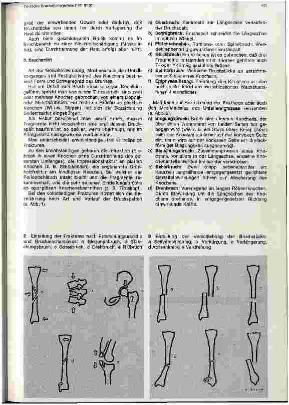 Vorschauseite 2: Allgemeine Lehre von den Knochenbrüchen