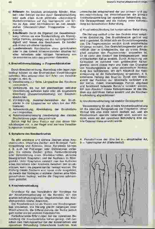 Vorschauseite 3: Allgemeine Lehre von den Knochenbrüchen