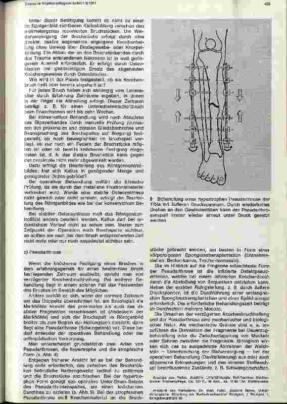 Vorschauseite 4: Allgemeine Lehre von den Knochenbrüchen