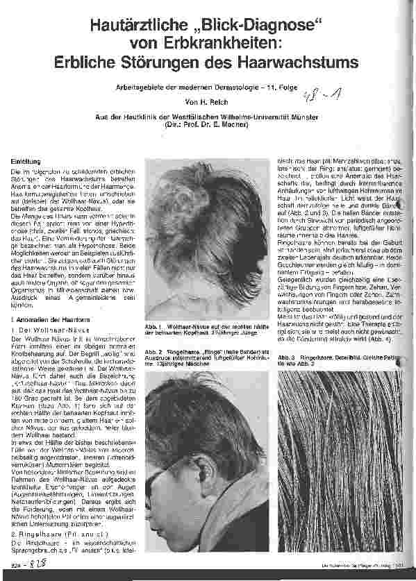 Vorschauseite 1: Hautärztliche Blick-Diagnose von Erbkrankheiten: Erbliche Störungen des Haarwachstums