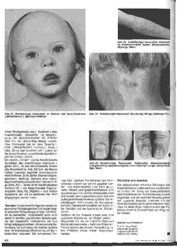 Vorschauseite 5: Hautärztliche Blick-Diagnose von Erbkrankheiten: Erbliche Störungen des Haarwachstums