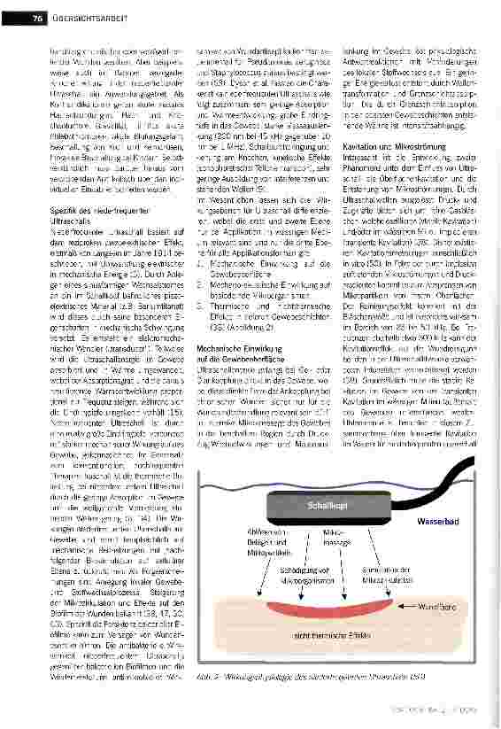 Vorschauseite 3: Niederfrequenter Ultraschall zur Therapie chronischer Wunden