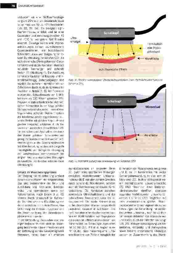 Vorschauseite 5: Niederfrequenter Ultraschall zur Therapie chronischer Wunden