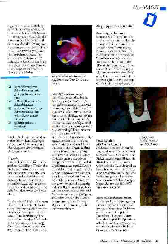 Vorschauseite 5: Erkrankung der Blase