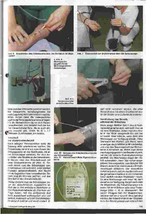 Vorschauseite 6: Autologe Bluttransfusion und isovolämische Hämodilution