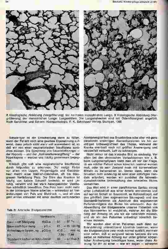 Vorschauseite 3: Indikation und Durchführung der Beatmung bei akuter und chronischer respiratorischer Infsuffizienz