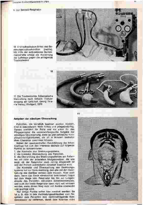 Vorschauseite 6: Indikation und Durchführung der Beatmung bei akuter und chronischer respiratorischer Infsuffizienz