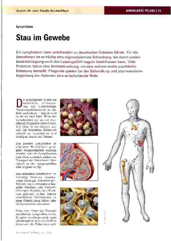 Vorschauseite 1: LymphödemStau im Gewebe