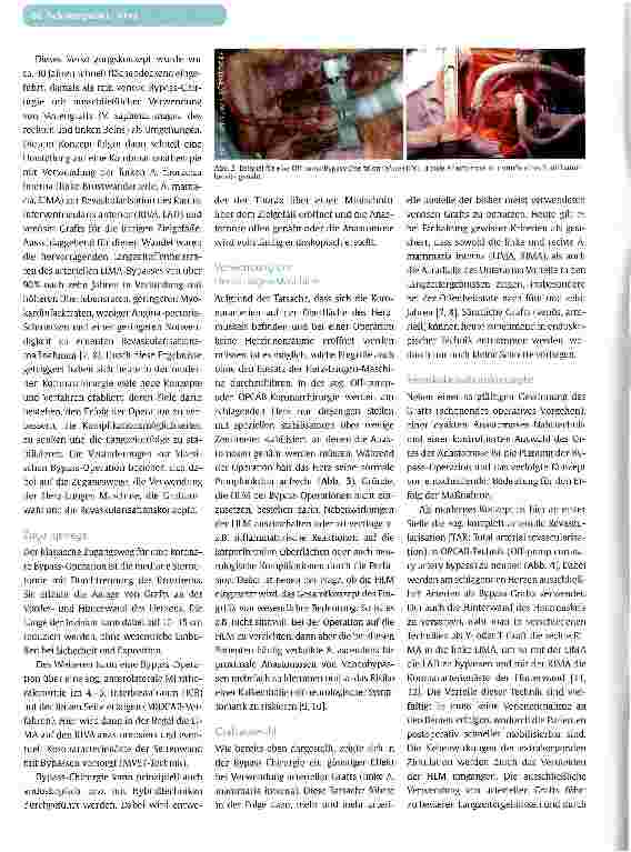 Vorschauseite 3: HERZCHIRURGIE IM JAHR 2011Neue Techniken und minimalinvasive Methoden