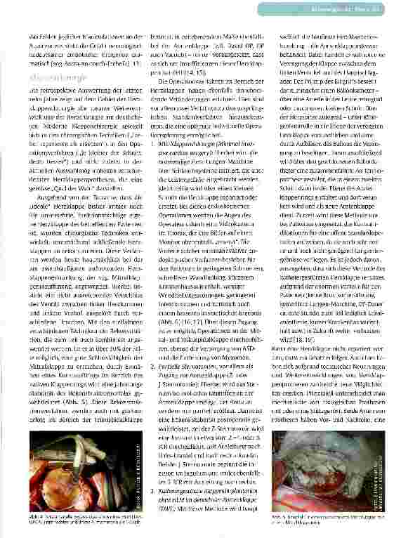 Vorschauseite 4: HERZCHIRURGIE IM JAHR 2011Neue Techniken und minimalinvasive Methoden
