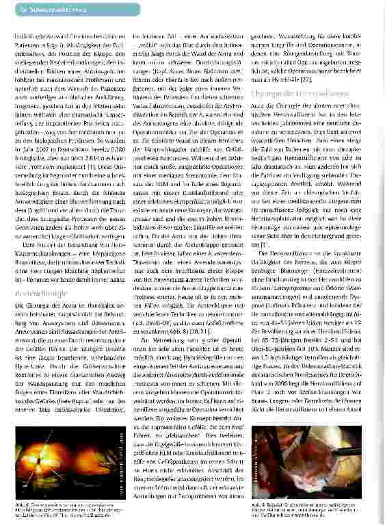 Vorschauseite 5: HERZCHIRURGIE IM JAHR 2011Neue Techniken und minimalinvasive Methoden