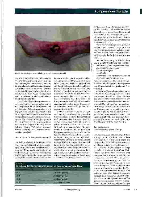 Vorschauseite 2: Kompressionstherapie beim Ulcus cruris venosum