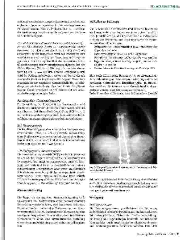 Vorschauseite 3: Atemmuskelfunktion und Beatmungstherapie bei neuromuskulären Erkrankungen