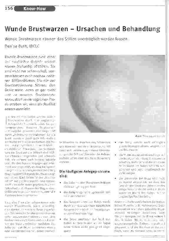 Vorschauseite 1: Wunde Brustwarzen - Ursachen und BehandlungWunde Brustwarzen können das Stillen unerträglich werden lassen.