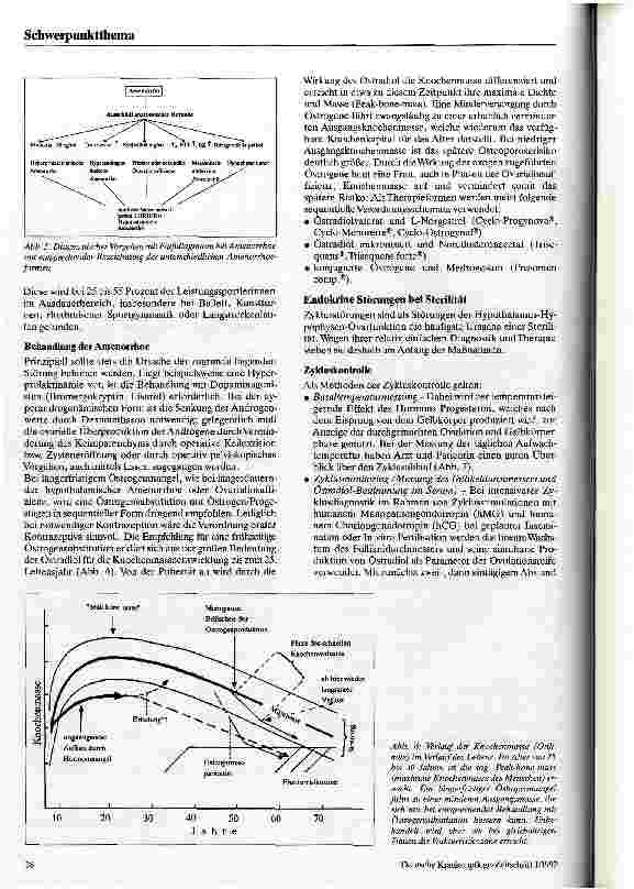 Vorschauseite 4: Gynäkologische Endokrinologie