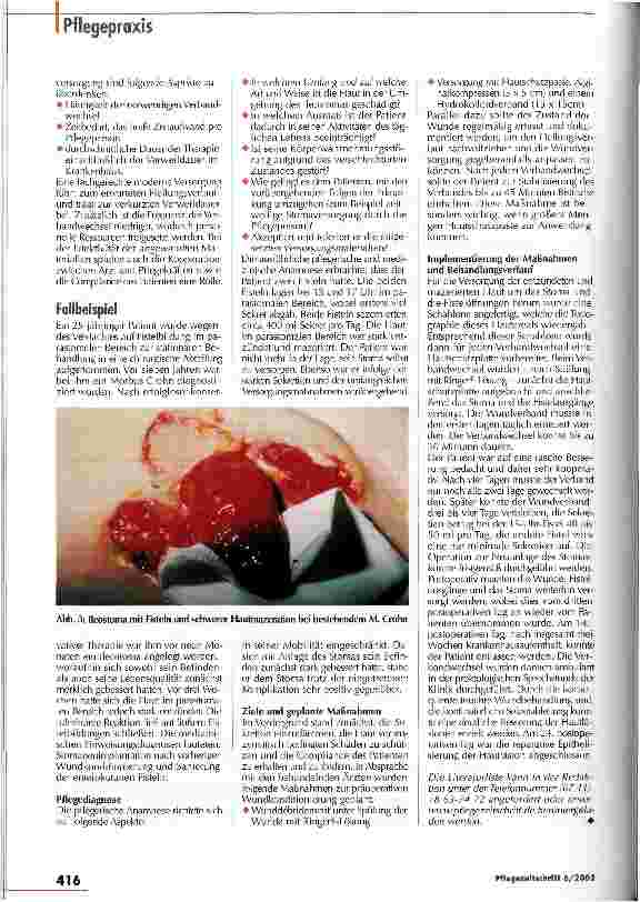 Vorschauseite 4: Es gibt keine Rezepte