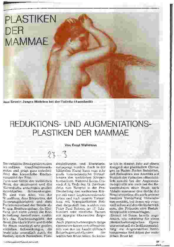 Vorschauseite 1: Reduktionsund Augmentationsplastiken der Mammae