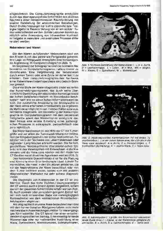 Vorschauseite 2: Die Computertomographie des Retroperitoneums und des Beckens Bericht aus der Strahlen-und Poliklinik Charlottenburg