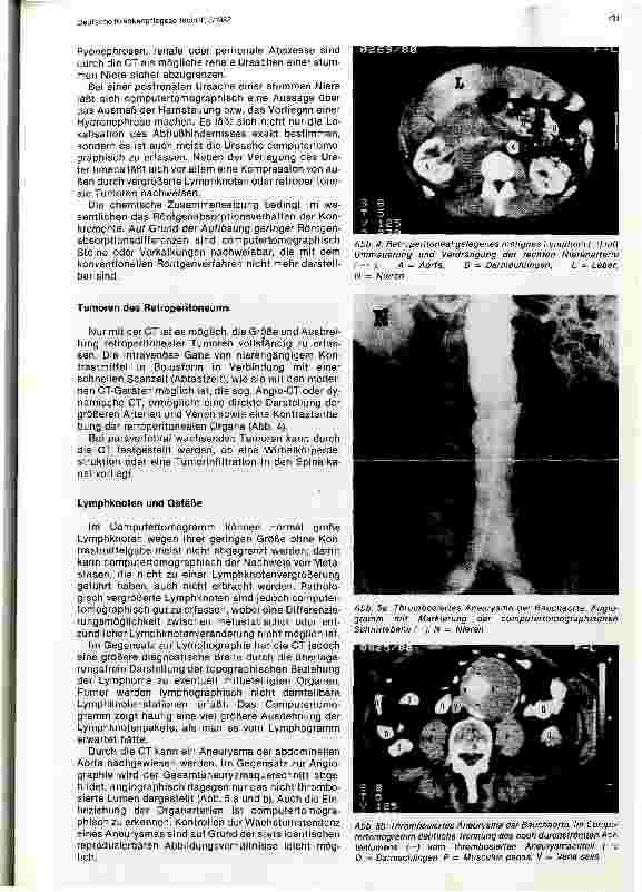 Vorschauseite 3: Die Computertomographie des Retroperitoneums und des Beckens Bericht aus der Strahlen-und Poliklinik Charlottenburg