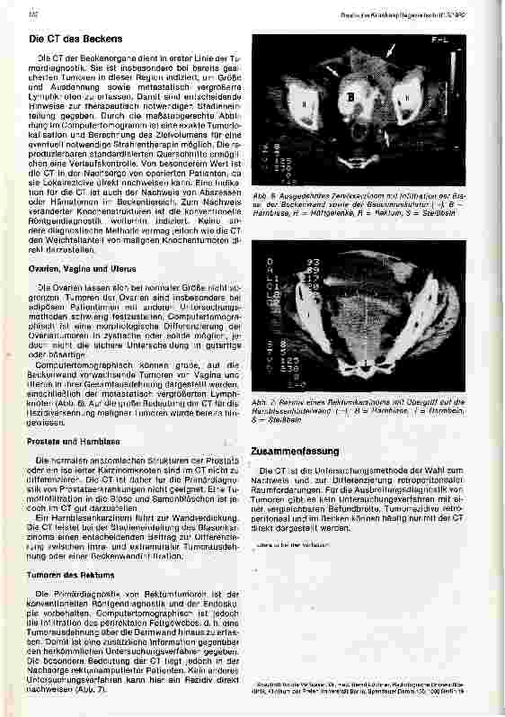 Vorschauseite 4: Die Computertomographie des Retroperitoneums und des Beckens Bericht aus der Strahlen-und Poliklinik Charlottenburg