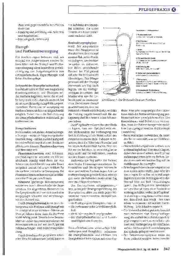 Vorschauseite 2: Stumpf undProthese richtig versorgen