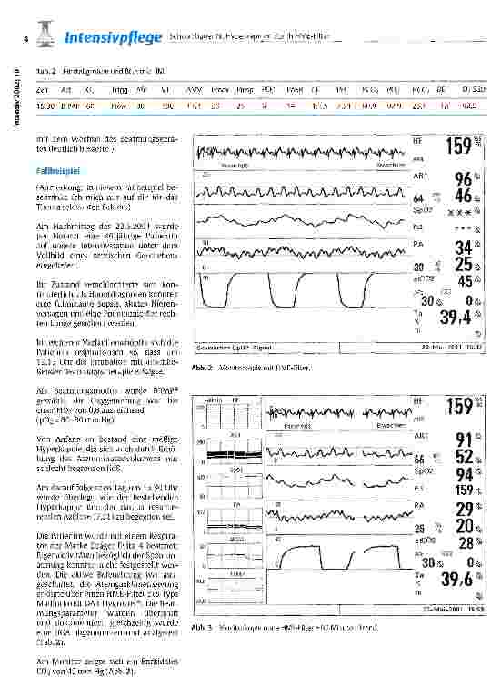 Vorschauseite 3: Hyperkapnien durch HME-Filter