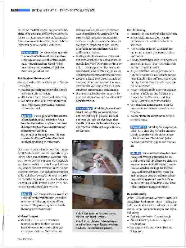 Vorschauseite 2: Basics - Tracheostoma pflege