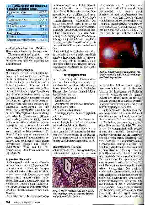 Vorschauseite 3: Krankheitsbilder und Behandlungsprinzipien der Endometriose