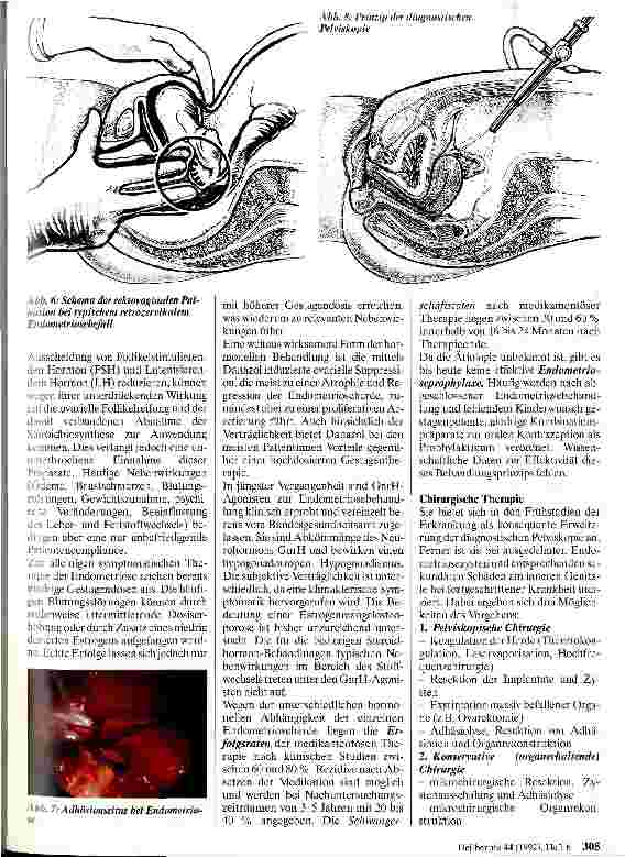 Vorschauseite 4: Krankheitsbilder und Behandlungsprinzipien der Endometriose