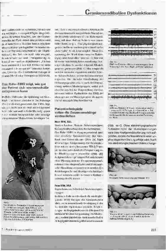 Vorschauseite 2: Die Bedeutung elektromyographischer Messungen in der Diagnostik und Therapie von craniomandibulären Dysfunktionen