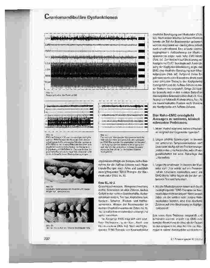 Vorschauseite 3: Die Bedeutung elektromyographischer Messungen in der Diagnostik und Therapie von craniomandibulären Dysfunktionen