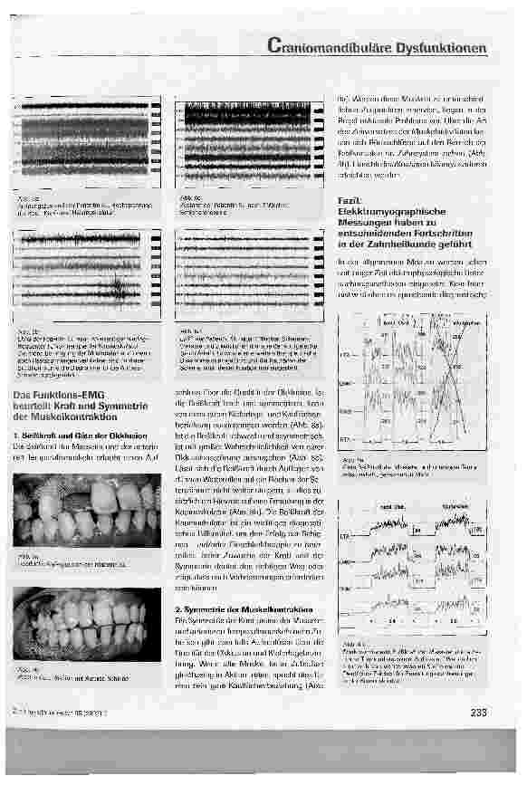 Vorschauseite 4: Die Bedeutung elektromyographischer Messungen in der Diagnostik und Therapie von craniomandibulären Dysfunktionen
