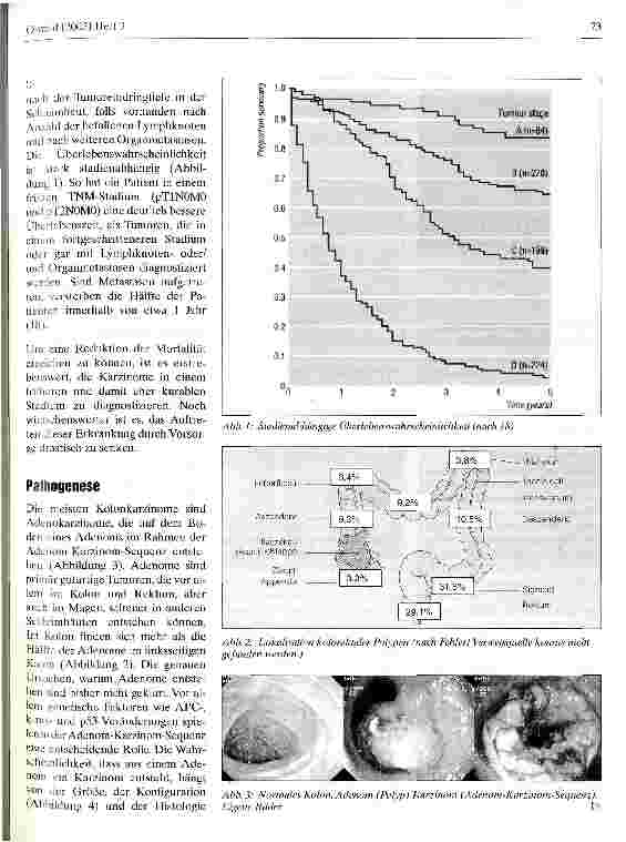 Vorschauseite 2: Darmkrebs-Update 2003 Vorsorge, Diagnostik und Therapie