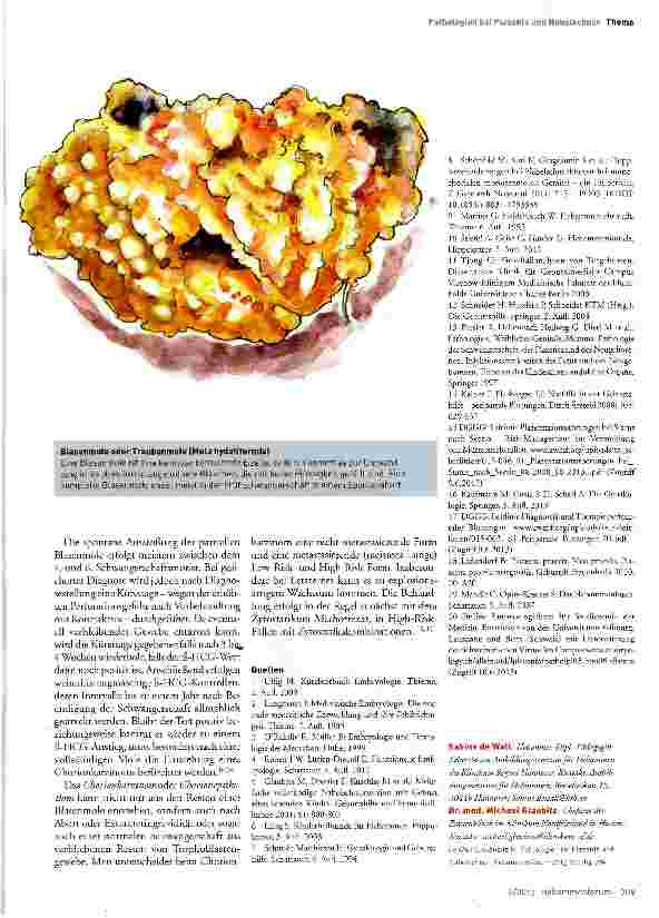 Vorschauseite 6: Pathologien bei Plazenta und Nabelschnur